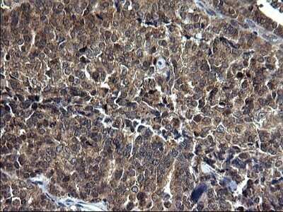 Immunohistochemistry: Sterol carrier protein 2 Antibody (OTI1E4) - Azide and BSA Free [NBP2-74401]