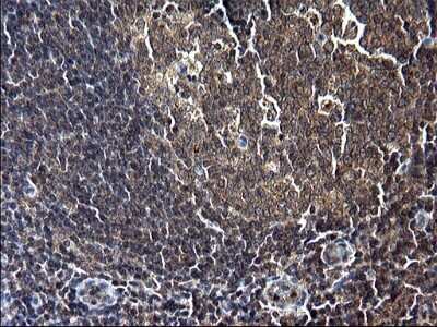 Immunohistochemistry: Sterol carrier protein 2 Antibody (OTI1E4) - Azide and BSA Free [NBP2-74401]