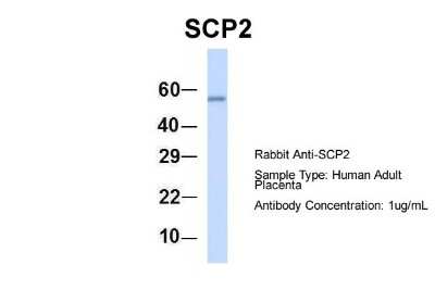 Western Blot: Sterol carrier protein 2 Antibody [NBP1-55214]