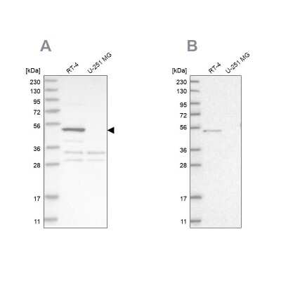 Western Blot: Sterol carrier protein 2 Antibody [NBP1-85958]