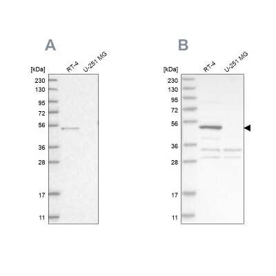 Western Blot: Sterol carrier protein 2 Antibody [NBP1-89514]