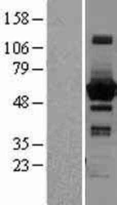 Western Blot: Sterol carrier protein 2 Overexpression Lysate [NBL1-15749]