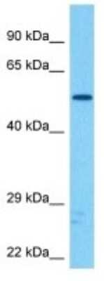 Western Blot: Stk-ps2 Antibody [NBP3-10259]