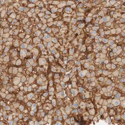 Immunohistochemistry-Paraffin: Stomatin Antibody [NBP1-88561]