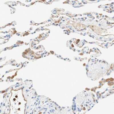 Immunohistochemistry-Paraffin: Stomatin Antibody [NBP1-88561]