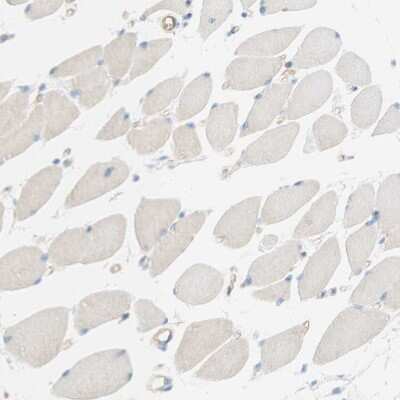 Immunohistochemistry-Paraffin: Stomatin Antibody [NBP1-88561]