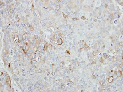 Immunohistochemistry-Paraffin: Stomatin Antibody [NBP2-20520]