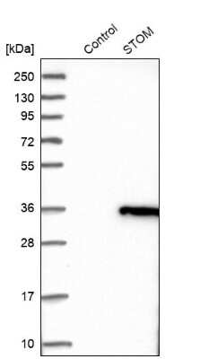 Western Blot: Stomatin Antibody [NBP1-88561]