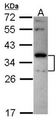 Western Blot: Stomatin Antibody [NBP2-20520]