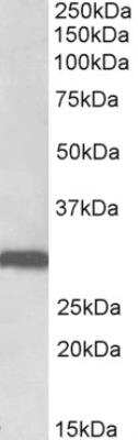 Western Blot: Stomatin Antibody [NBP2-26195]