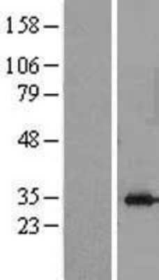 Western Blot: Stomatin Overexpression Lysate [NBL1-16561]