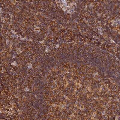 Immunohistochemistry-Paraffin: Stomatin-like protein 1 Antibody [NBP1-92455]