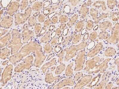 Immunohistochemistry-Paraffin: Stomatin-like protein 1 Antibody [NBP2-97965]