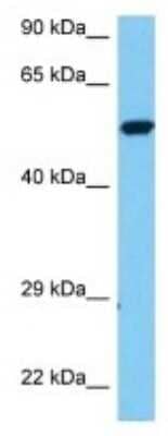 Western Blot: Stomatin-like protein 1 Antibody [NBP3-10175]