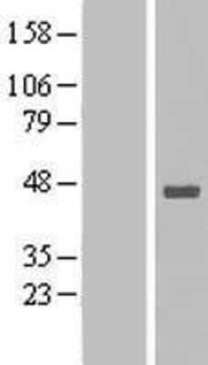 Western Blot: Stomatin-like protein 1 Overexpression Lysate [NBL1-16562]