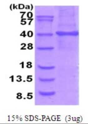 SDS-PAGE: Recombinant Human Stomatin-like protein 1 His Protein [NBP2-51951]