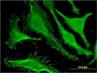 Immunocytochemistry/ Immunofluorescence: Stonin-1 Antibody (1F3) [H00011037-M01]