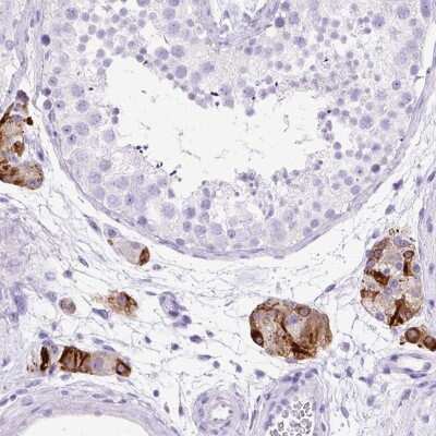 Immunohistochemistry: Storkhead Box 2 Antibody [NBP2-30480]