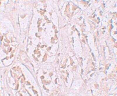 Immunohistochemistry: Storkhead Box 2 Antibody - BSA Free [NBP2-81978]
