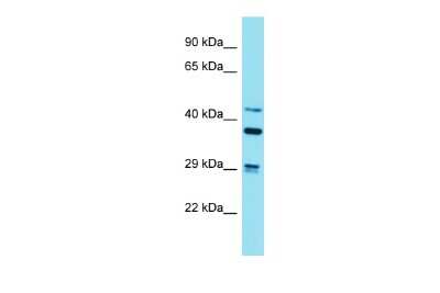 Western Blot: Striatin Antibody [NBP2-85841]