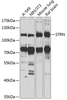 Western Blot: Striatin AntibodyBSA Free [NBP2-93410]