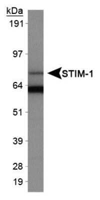 Western Blot: STIM1 AntibodyBSA Free [NB110-60547]
