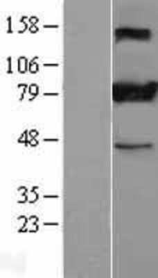 Western Blot: STIM1 Overexpression Lysate [NBL1-16538]