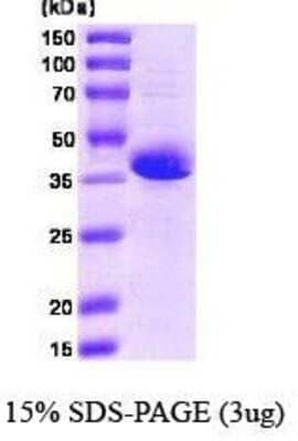 SDS-PAGE: Recombinant Human STIM1 Calmodulin Protein [NBC1-18404]