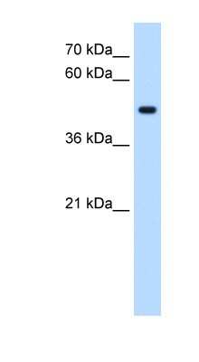 Western Blot: STYK1 Antibody [NBP1-59491]