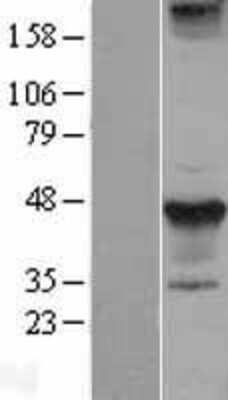 Western Blot: STYK1 Overexpression Lysate [NBL1-16590]