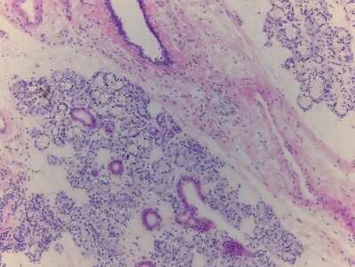 Hematoxylin & Eosin Stain: Submaxillary gland Tissue Slides (Adult Normal)- Frozen [NBP2-77576]