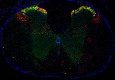 Immunohistochemistry-Frozen: Substance P Antibody (NC1/34) [NB100-65219]