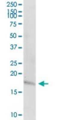 Western Blot: Preprotachykinin-1 Antibody [H00006863-D01P]