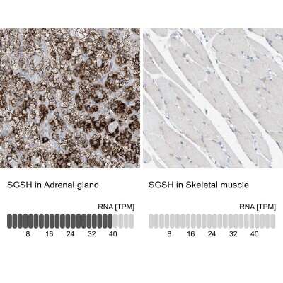 Immunohistochemistry-Paraffin: Sulfamidase/SGSH Antibody [NBP1-83164]