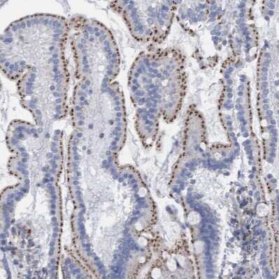 Immunohistochemistry-Paraffin: Sulfamidase/SGSH Antibody [NBP1-83164]