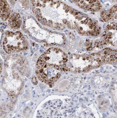 Immunohistochemistry-Paraffin: Sulfamidase/SGSH Antibody [NBP1-83164]