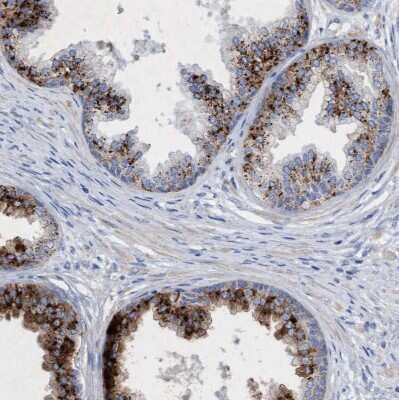 Immunohistochemistry-Paraffin: Sulfamidase/SGSH Antibody [NBP1-83164]