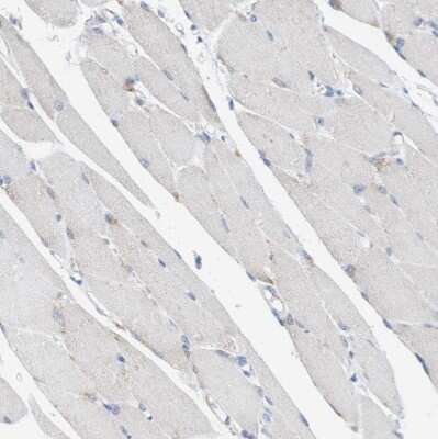 Immunohistochemistry-Paraffin: Sulfamidase/SGSH Antibody [NBP1-83164]