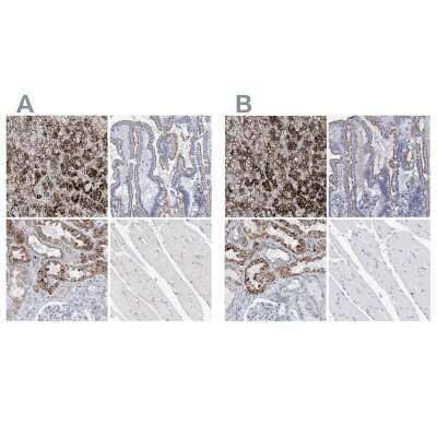 Immunohistochemistry-Paraffin: Sulfamidase/SGSH Antibody [NBP1-83164]