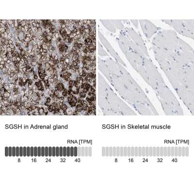 Immunohistochemistry-Paraffin: Sulfamidase/SGSH Antibody [NBP1-83165]