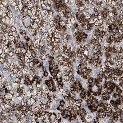 Immunohistochemistry-Paraffin: Sulfamidase/SGSH Antibody [NBP1-83165]