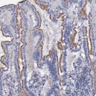 Immunohistochemistry-Paraffin: Sulfamidase/SGSH Antibody [NBP1-83165]