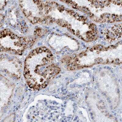 Immunohistochemistry-Paraffin: Sulfamidase/SGSH Antibody [NBP1-83165]