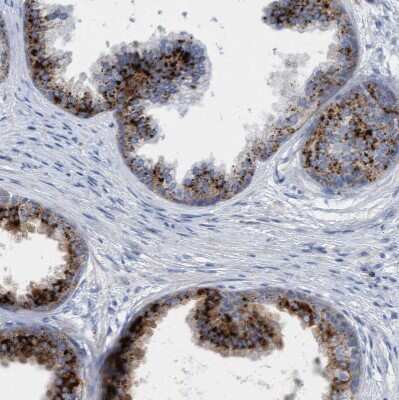 Immunohistochemistry-Paraffin: Sulfamidase/SGSH Antibody [NBP1-83165]