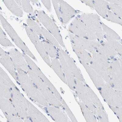 Immunohistochemistry-Paraffin: Sulfamidase/SGSH Antibody [NBP1-83165]