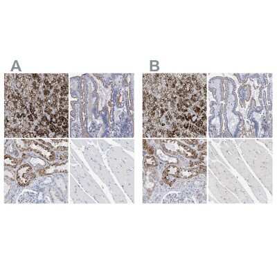 Immunohistochemistry-Paraffin: Sulfamidase/SGSH Antibody [NBP1-83165]