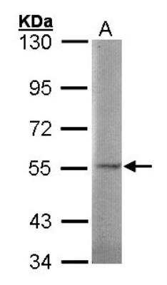 Western Blot: Sulfamidase/SGSH Antibody [NBP1-32061]