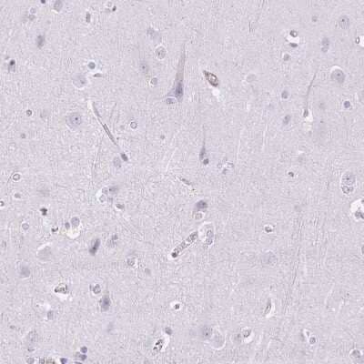 Immunohistochemistry-Paraffin: Sulfatase 1 Antibody [NBP2-31584]