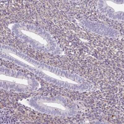 Immunohistochemistry-Paraffin: Sulfatase 1 Antibody [NBP2-31584]