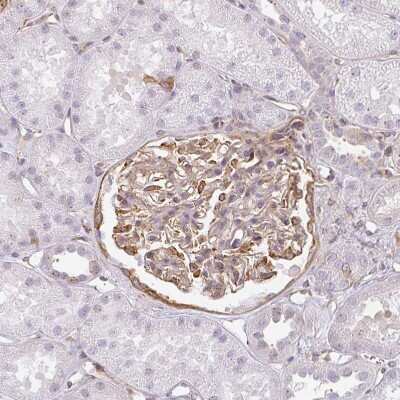 Immunohistochemistry-Paraffin: Sulfatase 1 Antibody [NBP2-31584]